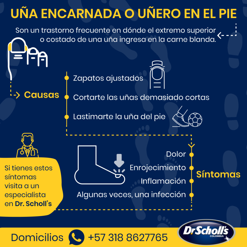 uña encarnada infografia